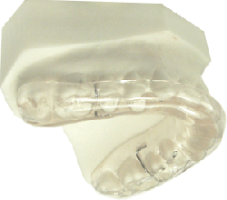 Upper Occlusal Acrylic Splint