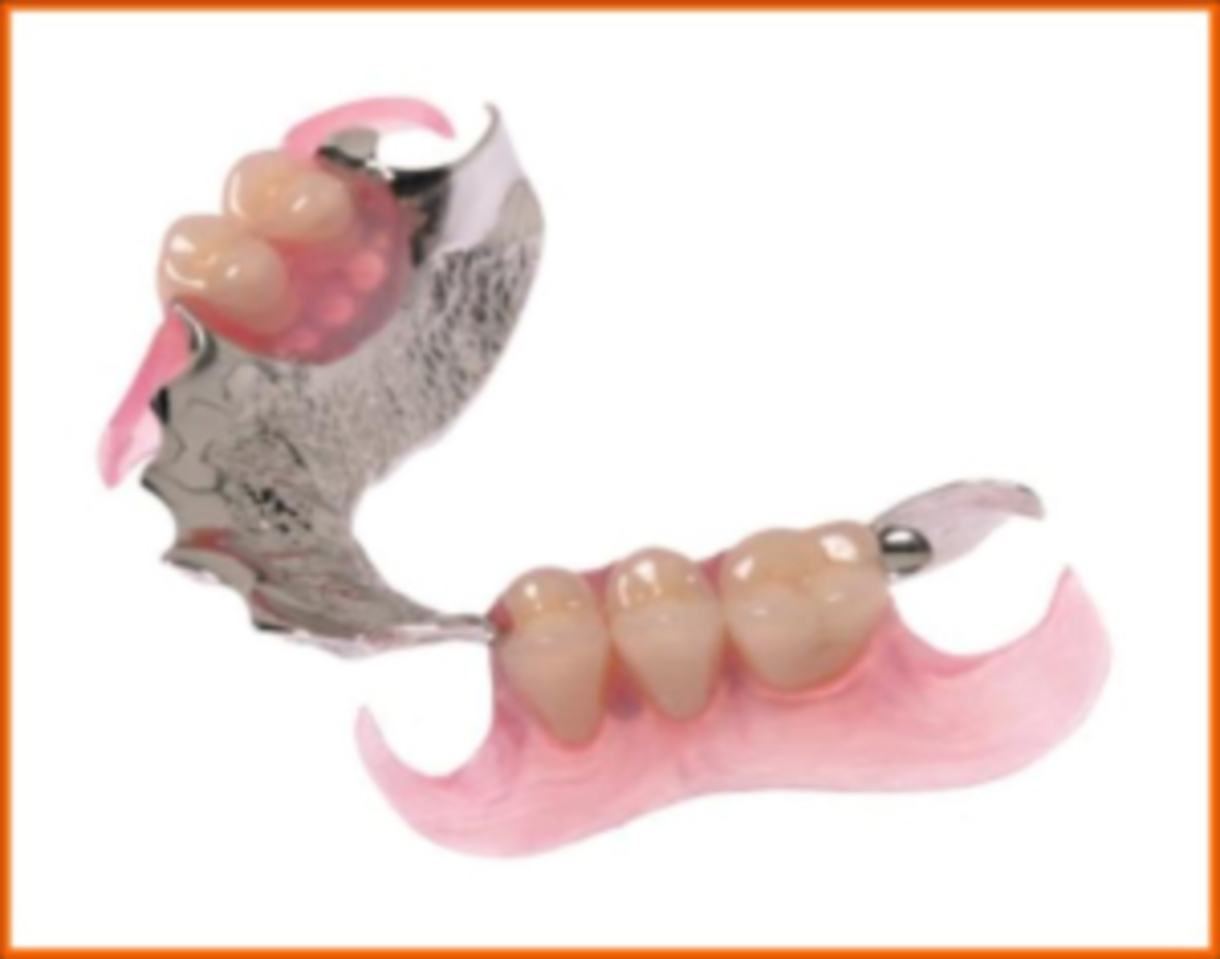 Orthodontic Appliances POL Orthodontic Laboratory